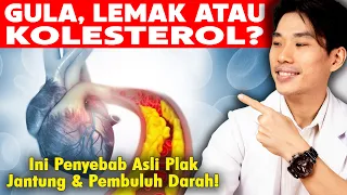 Plak Pembuluh Darah Terbentuk Karena Gula, Lemak atau Kolesterol?