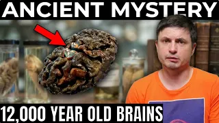 Why Thousands of Ancient Brains Refuse to Decompose