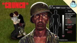 Types Of Players When They Get Bitten - Project Zomboid
