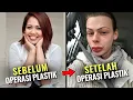 Download Lagu Tak Sesuai Harapan! Deretan Artis Indonesia Ini Gagal Operasi Plastik