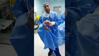 شاهد شكل المعدة بعد العملية  شاهد شكل المعدة بعد العملية
