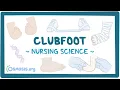 Clubfoot: Clinical Nursing Care