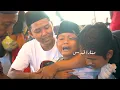 Download Lagu Tak Hanya Khitan! Masjid Al-Aqsha Menara Kudus Juga Berikan Perawatan Pasca Khitan Gratis!