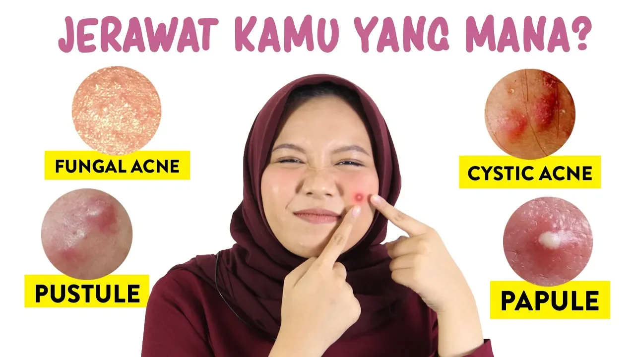 Halo sobat sehat, selamat datang di chanel Magenta Health. Kali ini kami akan menyajikan informasi t. 