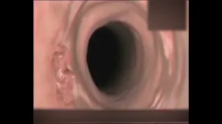 المنظار ايه هو دكتور علي احمد شفيق 