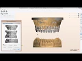 Digital Orthodontic Models Scanning