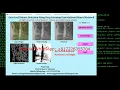 Corn Leaf Disease Classification Using CNN Python Code Corn Plant Disease Identification