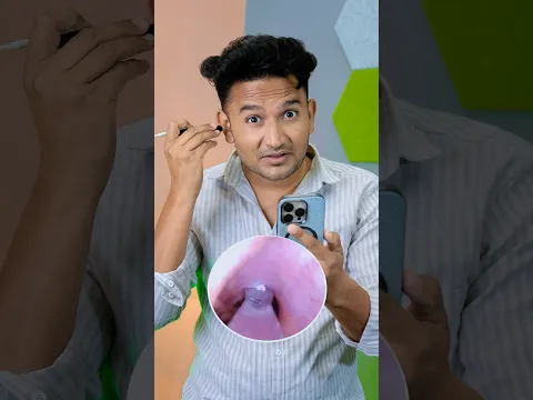 Top 5 Ear Cleaning Devices #shorts #devkefacts
