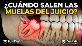 Cuando salen las MUELAS JUICIO | Guía completa