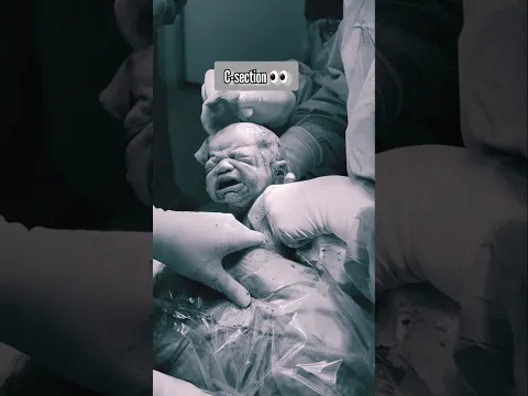 ๐ A Mother's First Hug After C-Section Will Melt Your Heart ๐ถโค๏ธ #Shorts #baby #mom #family