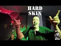 Lagu HARD SKIN - Live Multicam - Levy Punk Weekender 2024 - MPRV News