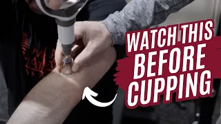 DO NOT USE CUPPING WITHOUT WATCHING THIS - When and Why Throwing Athletes Should Use Cupping Therapy