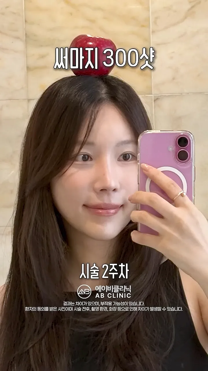 써마지 효과 없어요?