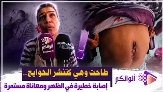 طاحت وهي كتنشر الحوايج.. إصابة خطيرة في الظهر ومعاناة مستمرة لابنة درب السلطان