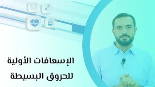 الإسعافات الأولية للحروق البسيطة 