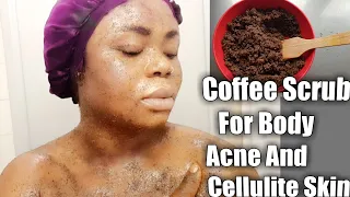 Download REQUESTED : How To Make Coffee Scrub For Body Acne And Cellulite skin | Bella Gold MP3