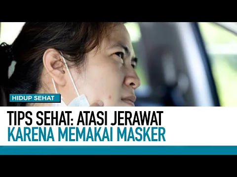 Cara Atasi Jerawat Karena Memakai Masker