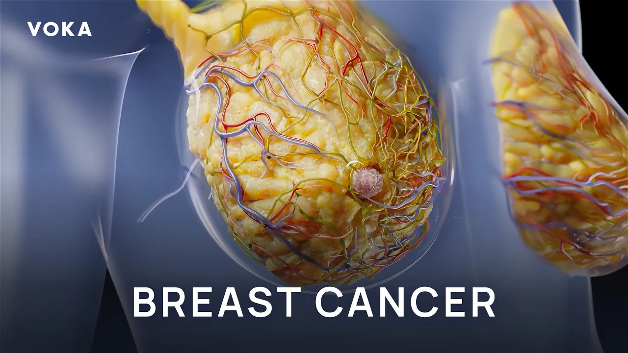 VOKA HER2-positive breast cancer mechanism