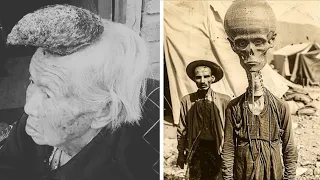 15 Disturbing Circus Monsters That Actually Existed
