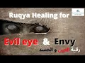 Download Lagu HEAL/DESTROY EVIL EYE AND ENVY (HASSAD)