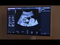 100 Ultrasounds in Pennsylvania Inspire Mothers to Choose Life