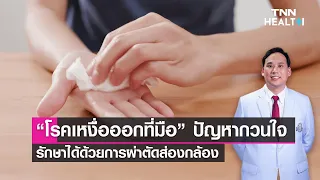 การรักษาโรคเหงื่อออกที่มือมีวิธีใดบ้าง