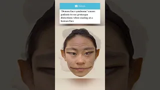 Here s what human faces look like to people with prosopometamorphopsia AKA demon face syndrome
