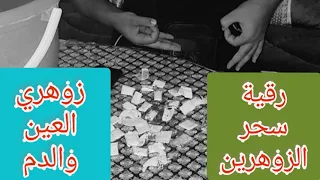 الرقية الشرعية للزوهريين المسحورين والتابعة السحر من الوالدين زوهري الدم والعينين  الرقية الشرعية للزوهريين المسحورين والتابعة السحر من الوالدين زوهري الدم والعينين