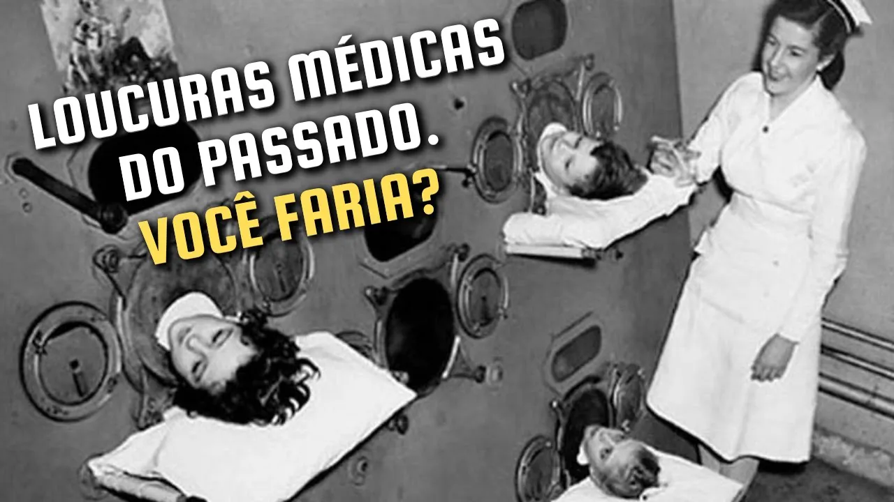 15 Práticas Médicas Loucas Do Passado Que Possuem Alternativas Baratas Hoje Em Dia - Parte 1
