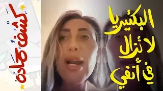كشف حمادة 39 البكتيريا لا تزال في أنفي 