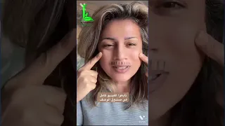 وداعا ترهل الشفة العلوية دندنها