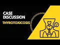 Case Discussion Thyrotoxicosis