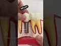 How To Replace A Missing Tooth