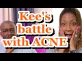How to correct acne skin problems