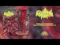 Download Lagu CEREBRAL ROT - Bowels Of Decrepitude (From 'Excretion Of Mortality' LP, 2021)