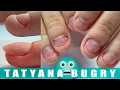 Download Lagu Transformation On EXTREMELY Bitten Nails | Fixing Bitten Nails With Polygel | Russian ,Efile Mani