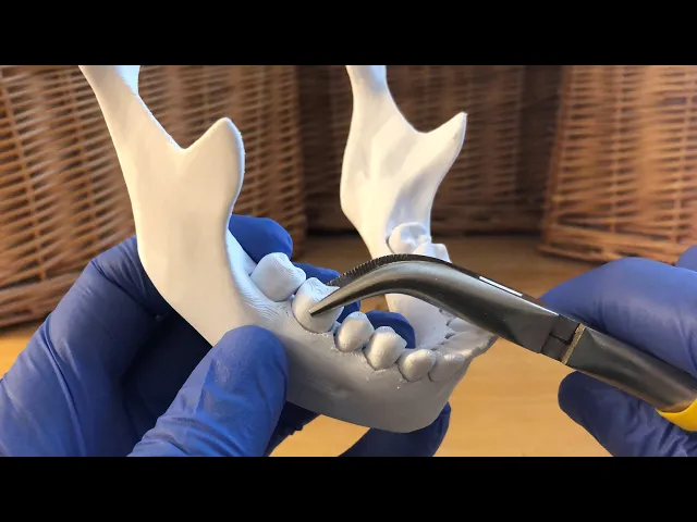 Loose Teeth video thumbnail
