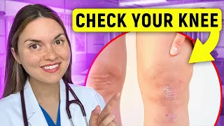 What Your KNEES Say About Your HEALTH: Arthritis Doctor Explains