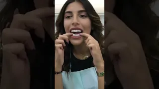 أسنان صناعية من السيليكون لابتسامة مثالية و دون عيوب متوفرة الجزائر الجزائر اليوم الجزائري وهران 