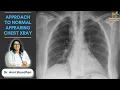 Approach to an Unremarkable Chest X-Ray Dr Avni Skandhan