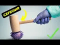 The Ultimate Guide to Cefdinir What You Need to Know About This Antibiotic