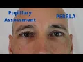 Pupillary Assessment PERRLA