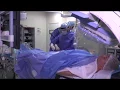 Download Lagu Coronarographie \u0026 pose de stents : explications avec les cardiologues de l'IMM