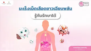  มะเร็งเม็ดเลือดขาวชนิดเฉียบพลัน มีอาการอะไรบ้างที่ควรสังเกต 