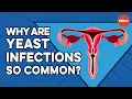 What causes yeast infections and how do you get rid of them - Liesbeth Demuyser