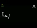 Download Lagu Kate nahi kat te din ye rat❤️ new love status ❤️ new whatsapp status ❤️ A Ali Creation