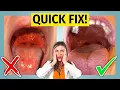 Strep Throat - treat it fast learn how