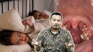 Ini Punca Dengkur Sampai Hilang Nafas