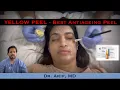 Yellow Retinol peel Best Antiageing Peel DrArifMDDermatologist