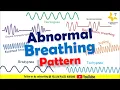 ABNORMAL BREATHING PATTERN Apnea Bradypnea Tachypnea Ataxic Sighing Cheyne-Stokes